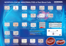 Morphological abnormalities of red blood cells thumbnail